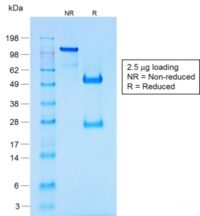 Data from SDS-PAGE analysis of Anti-Chromogranin A antibody (Clone CHGA/1731R). Reducing lane (R) shows heavy and light chain fragments. NR lane shows intact antibody with expected MW of approximately 150 kDa. The data are consistent with a high purity, intact mAb.